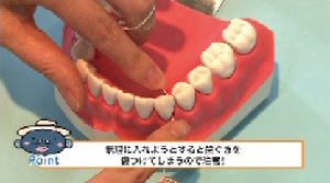 むし歯・歯周病予防対策！補助用具の使い方